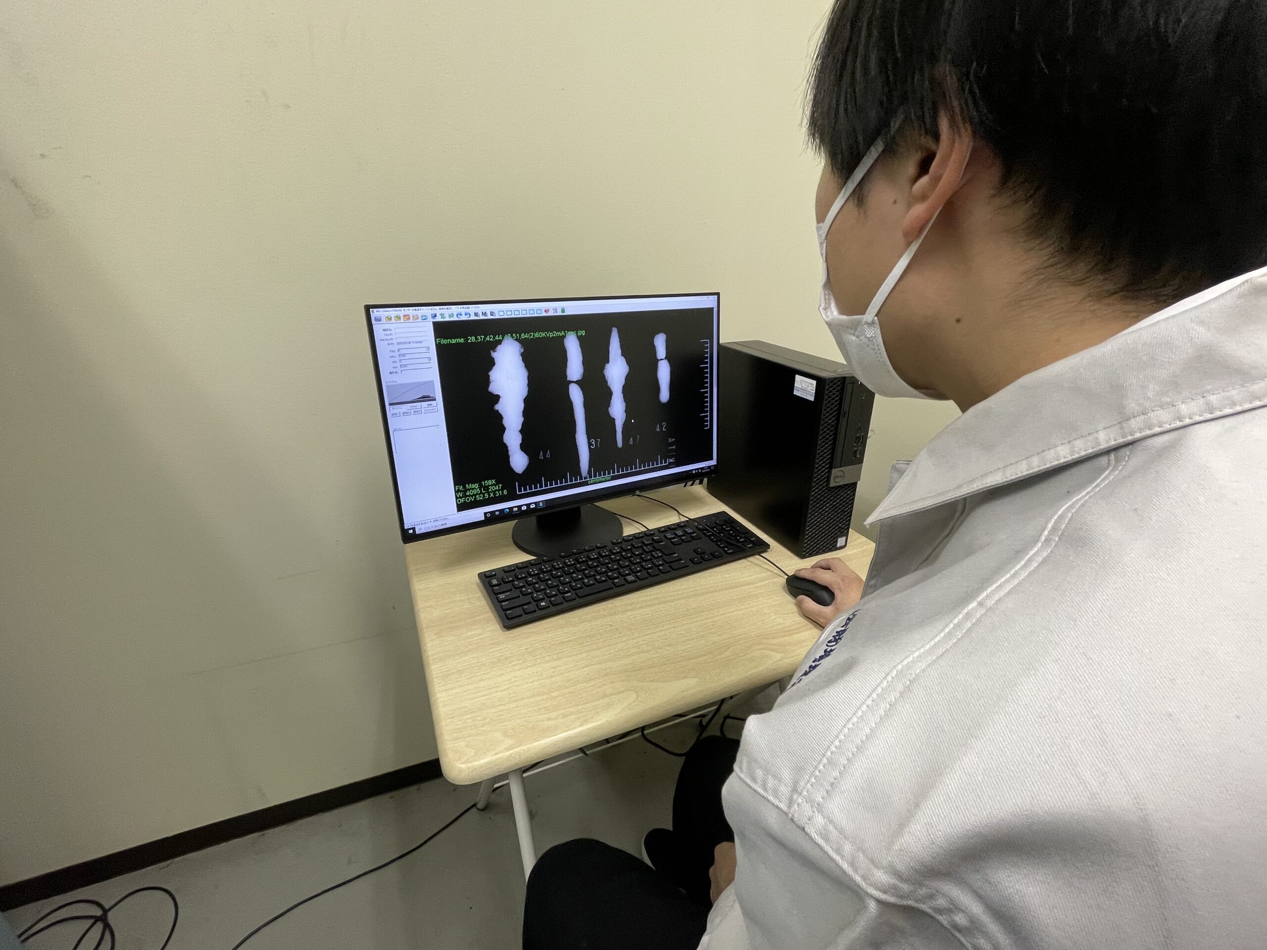 ① X線透過撮影